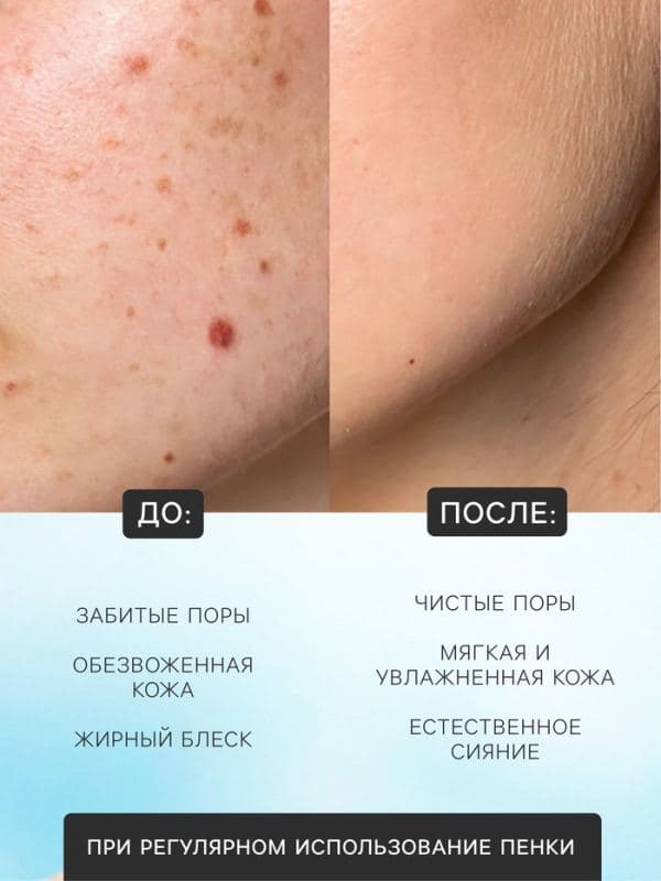 Пенка для умывания с щеткой, для всех типов кожи, с гиалуроновой кислотой, 120 мл — фото 2